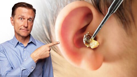 What Does LOTS of EARWAX Buildup Mean_