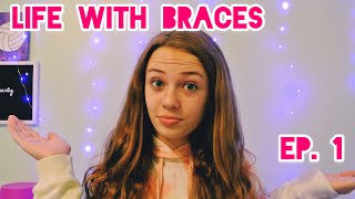 Life With Braces Episode 1! | Getting braces on | What you need to know | Gabby’s Gallery