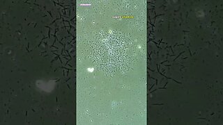Lemon Juice vs bacteria, Under Microscope.