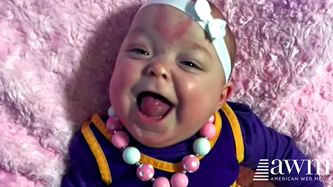 Doctors Thought The Delivery Of Their Baby Went As Planned, Then They Look At Her Tongue
