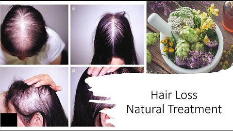 Hair Loss Natural Treatment