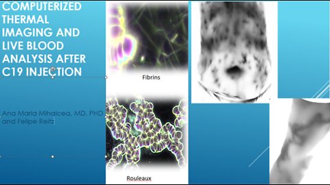 Computerized Thermographic Imaging and Live Blood Analysis post C19 injection
