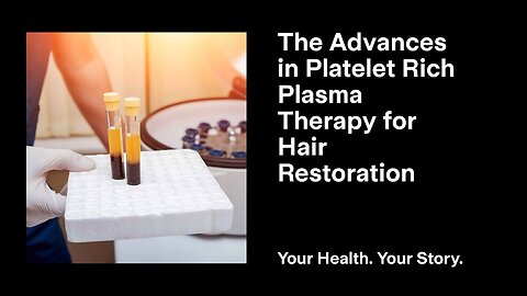 The Advances in Platelet Rich Plasma Therapy for Hair Restoration