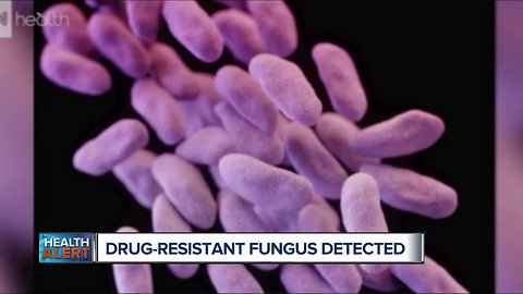 Ask Dr. Nandi: Why this drug-resistant fungus is spreading