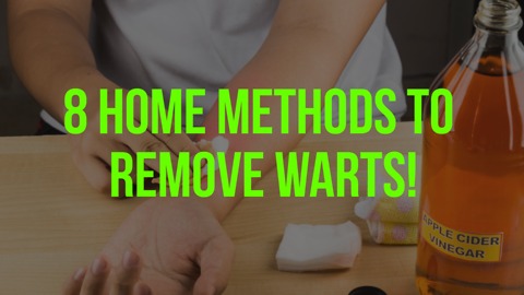 8 Home Methods to Remove Warts!