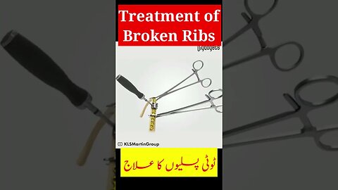 Surgical Treatment of Broken Ribs #shorts