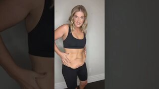 Excess Skin After Losing 100 Pounds
