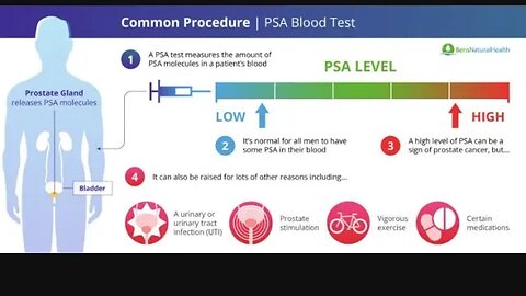 #prostatecancer thyroid, depression, New data high PSA good or bad? High low hormones pituitary?