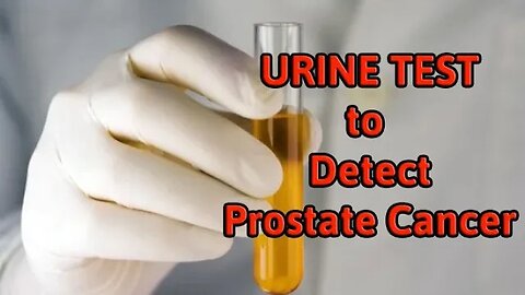 A Urine Test to Detect Prostate Cancer
