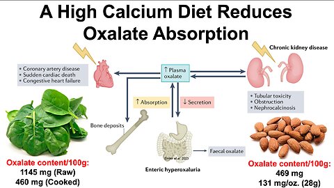 A High Calcium Diet Reduces Oxalate Absorption