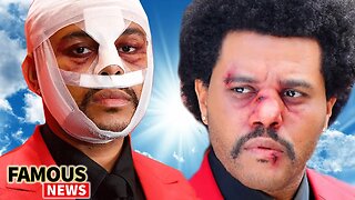 The Weeknd Can't Feel His Face | What's With The Bandages? | Famous News