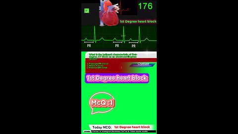 First degree heart blockages #firstdegreeavblock #arrthymias #CardiacArrhythmia #Cardiology