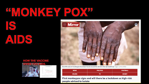 MONKEY POX IS AIDS