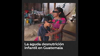 La desnutrición infantil asola a Guatemala