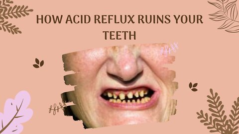 How Acid Reflux Ruins Your Teeth