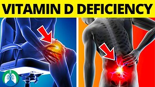 ☀️Top 10 Signs of Vitamin D Deficiency That You MUST Know