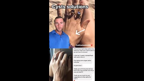 Cyst Solutions