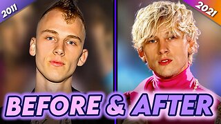 MGK | Before & After | Hair Transplant, Tattoos, Punk Wardrobe & More