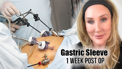 Gastric Sleeve Surgery - I week Update & Weight Loss