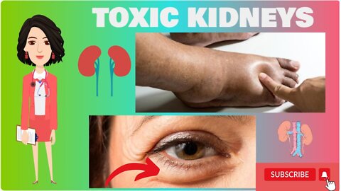 10 Warning Signs That Your Kidneys Are Toxic | Signs Your Kidneys Are Trying to Tell You Something
