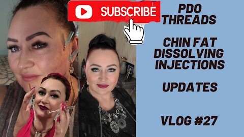 UPDATES FAT INJECTIONS NEOBELLA/KABELLINE AND PDO COGS THREADS 23G60MM PICS BEFORE AND AFTER! VLOG27