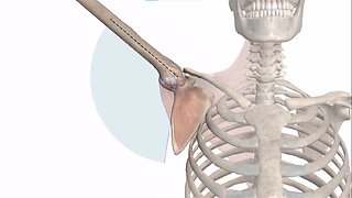 Human Animated Anatomy of Adhesive capsulitis 03 shoulder anatomy and function