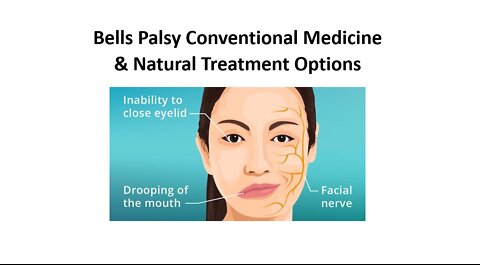 Bells Palsy Treatment Options Conventional & Natural