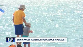 Skin cancer rate: Buffalo above average