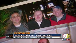 Bill would criminalize Down syndrome abortions