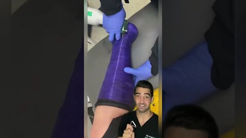 Cast Removal