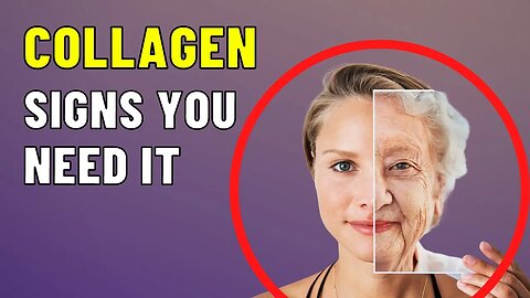 Signs You Need More Collagen