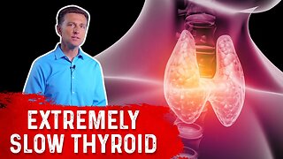 How To Lose Weight With An Extremely Slow Thyroid? – Dr.Berg On Hypothyroidism & Weight Loss