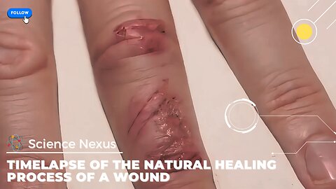 Timelapse of a wound’s natural healing process
