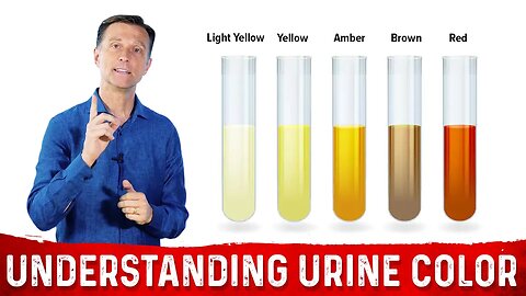 What Urine Color Indicates About Your Body – Dr.Berg