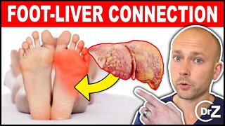 What Your FEET Can Tell You About Your Liver - Surprising Symptoms!