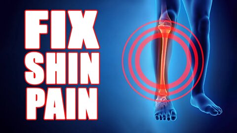 Got Shin Splints? Do This Simple Exercise For Instant Relief