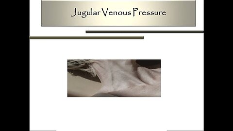 Examination of Jugular Venous Pressure and JVP waveform.