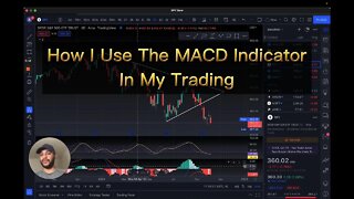 How I Use the MACD Indicator in my trading!!