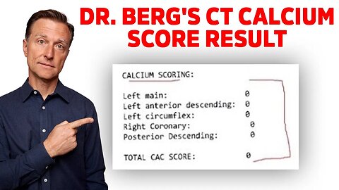 Dr.Berg's Reaction on his CT Calcium Scoring Test Result
