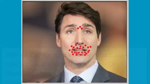 What if a Contagious Joe Biden Gave Justin Trudeau the New Monkeypox Variant? (Parody)