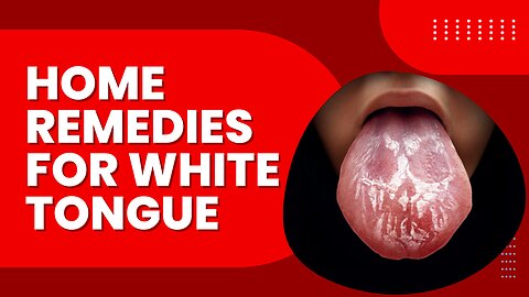 Home Remedies For White Tongue