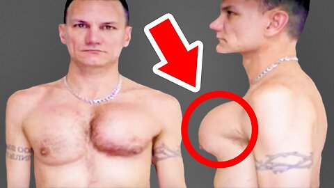 When Fake Muscles Go Wrong - Part 2