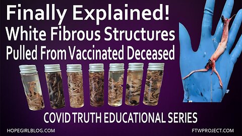 Finally Explained! White Fibrous Clots From Vaccinated Deceased
