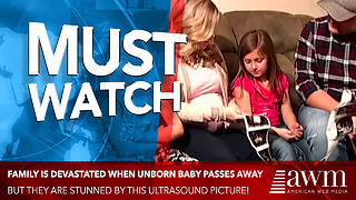 Family Is Devastated Baby In Mom’s Belly Passed Away, Then They Spot It On The Ultrasound