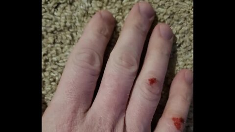[2022-12-25] Got ganged again. Almost lost a finger on one hand. Smashed knuckles. [XUYAgWGI1XU]
