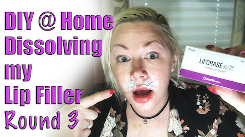 Dissolving my Lip Filler : Round 3 | Code Jessica10 saves you Money