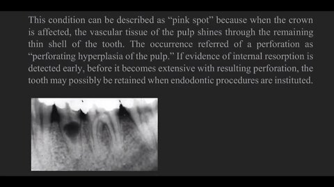 Pedodontics L16 (Reaction of the Tooth to Trauma)