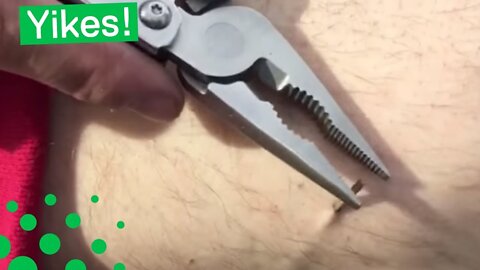 SKATEBOARDER REMOVES LARGE SPLINTER FROM LEG