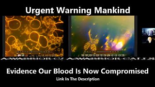 Urgent Warning Mankind - Evidence Our Blood Is Now Compromised