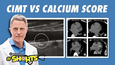 #SHORTS CIMT vs. Calcium Score